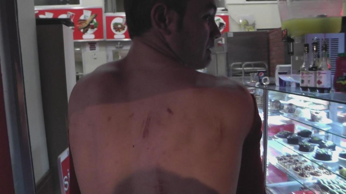 Turkey: An Ankara baker's story of unprovoked police violence