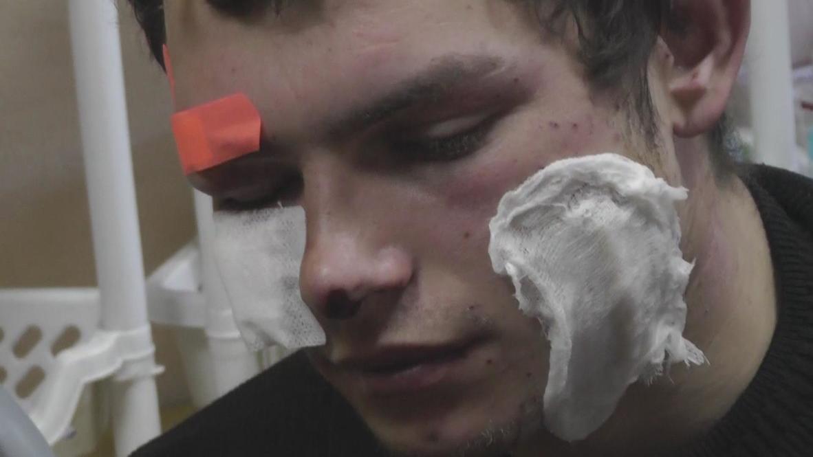 Ukraine: Injuries increase as police throw grenades, fire bullets
