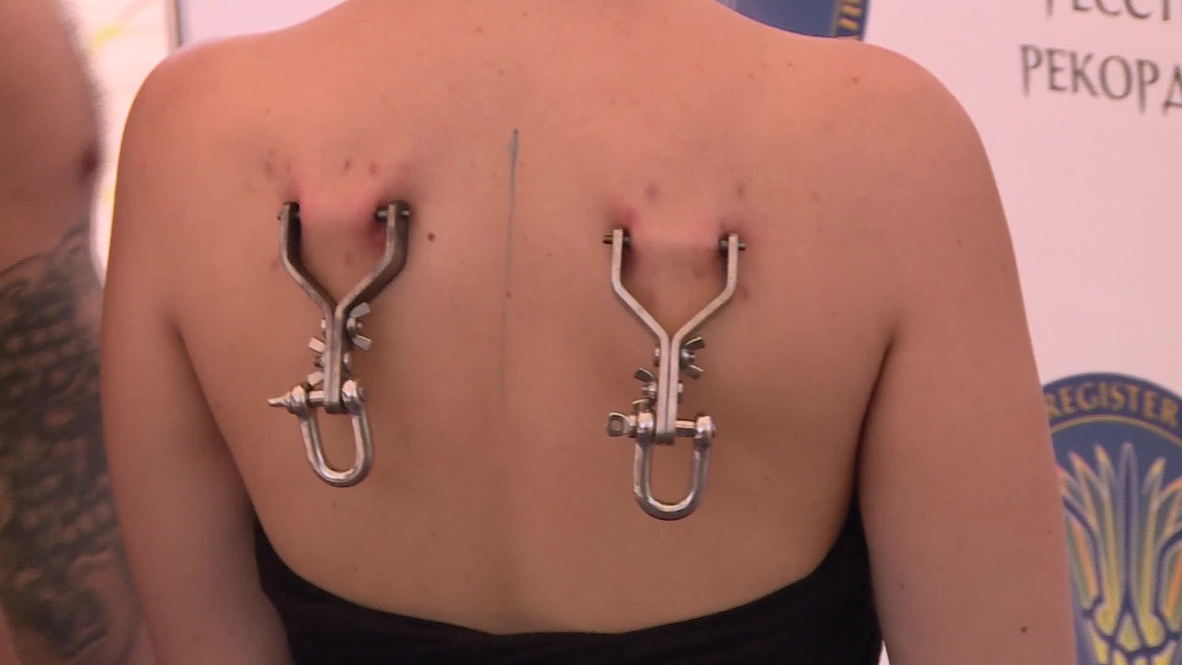 Ukraine: Hooked-up couples show love is pain
