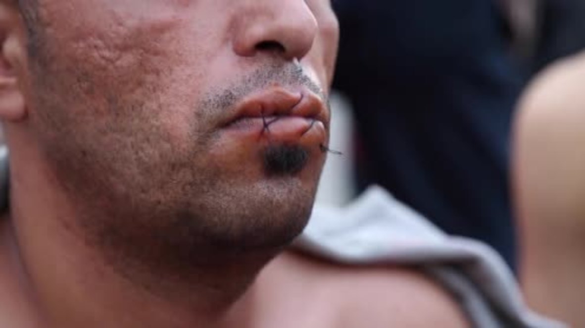 Greece: Iranian refugees sew mouths shut to protest Macedonia's policies