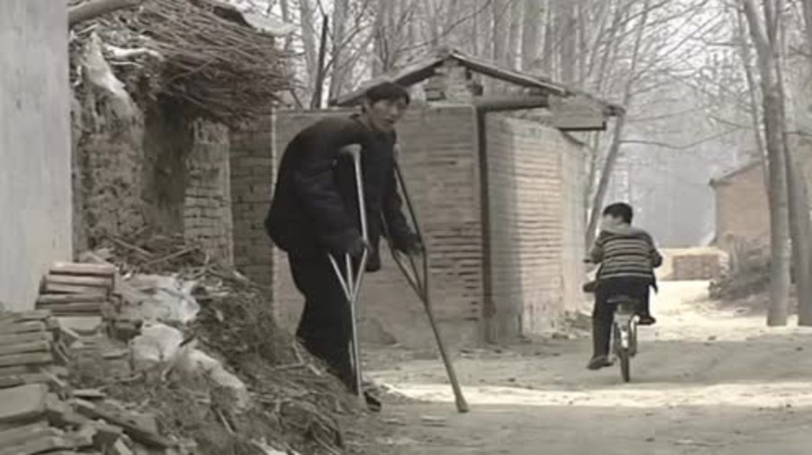 China: Tallest man in China to undergo life changing surgery