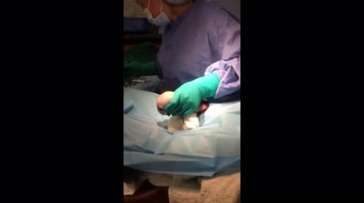UK: Voldemort returns! Has Harry Potter's nemesis been reborn as a baby MONKEY?