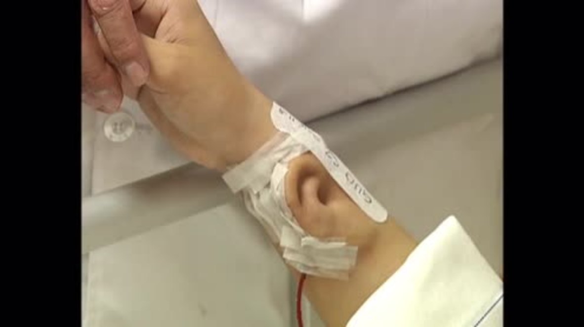 China: Doctor transplants ear onto patient's arm using breakthrough techniques