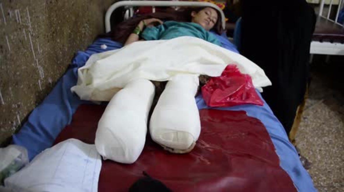 Afghanistan: Ten-year-old Shazia loses legs due to landmine