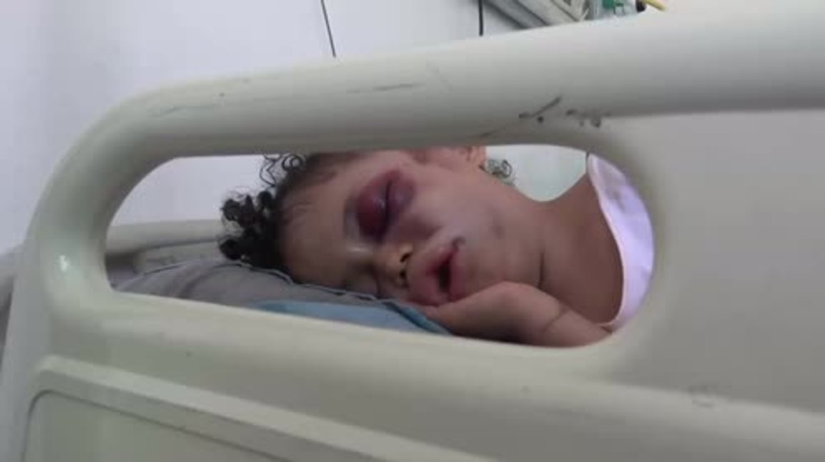 Yemen: Six y/o Buthaina is sole survivor as Saudi-led airstrike wipes out her entire family