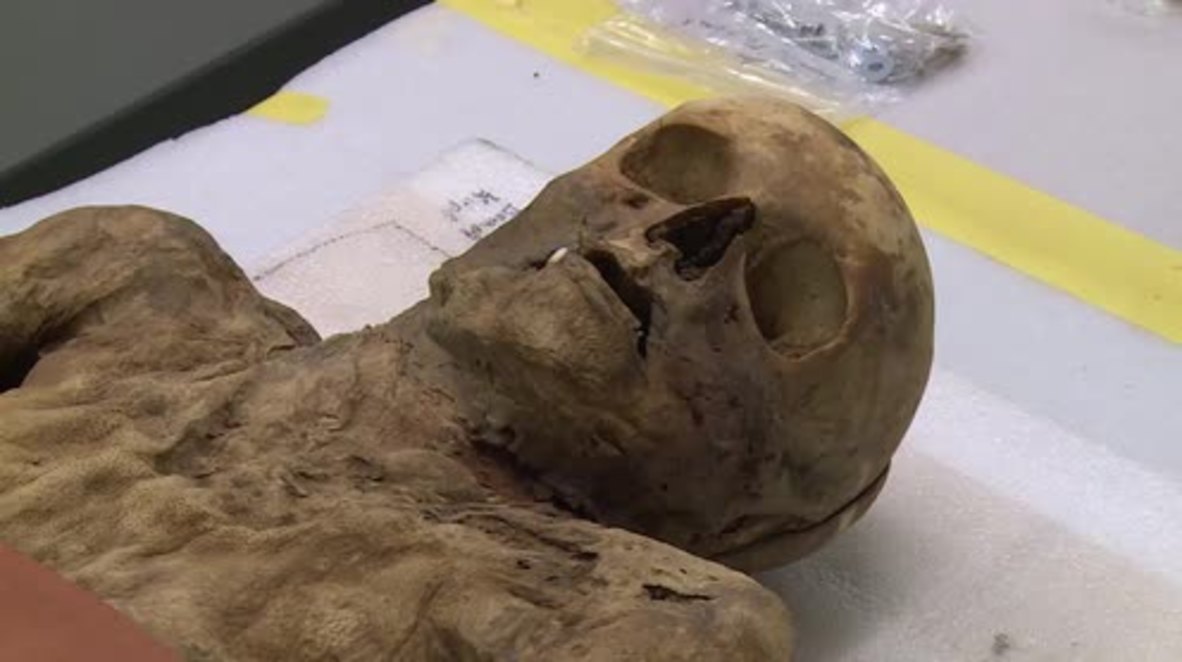 Syphilis-ridden mummified corpse found to be Boris Johnson's ancestor