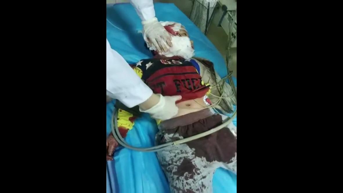 China: 14 niños son apuñalados por una mujer armada con un cuchillo en una guardería de Chongqing *EXPLÍCITO*