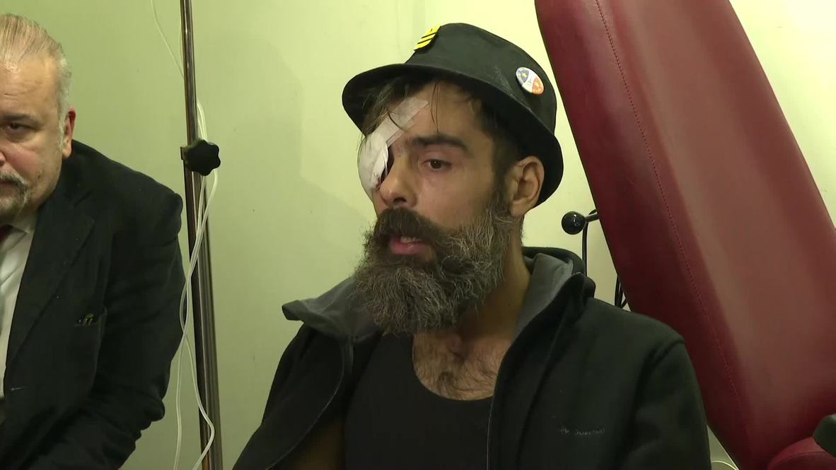 France: Injured prominent Yellow Vests activist says he was shot in the eye