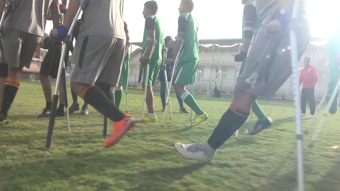 Futbolistas amputados demuestran que el deporte no conoce límites