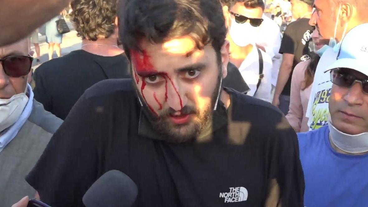 Italia: Policía se enfrenta a manifestantes contrarios a Salvini en Mondragone
